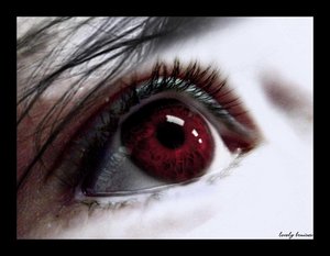 1129477263_uresredeye.jpg